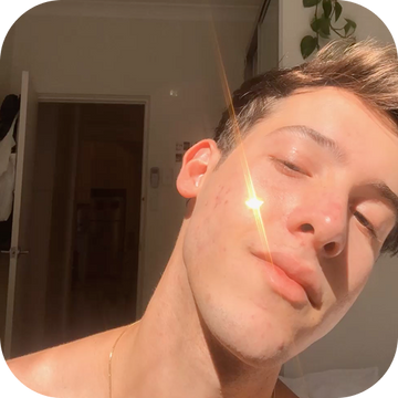 I Found Out Our Star Patches Reflect UV Light… by Accident 🤭