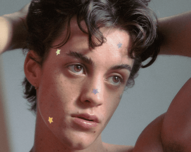 Holographic Star Pimple Patches on boys face healing pimples, zits and whiteheads