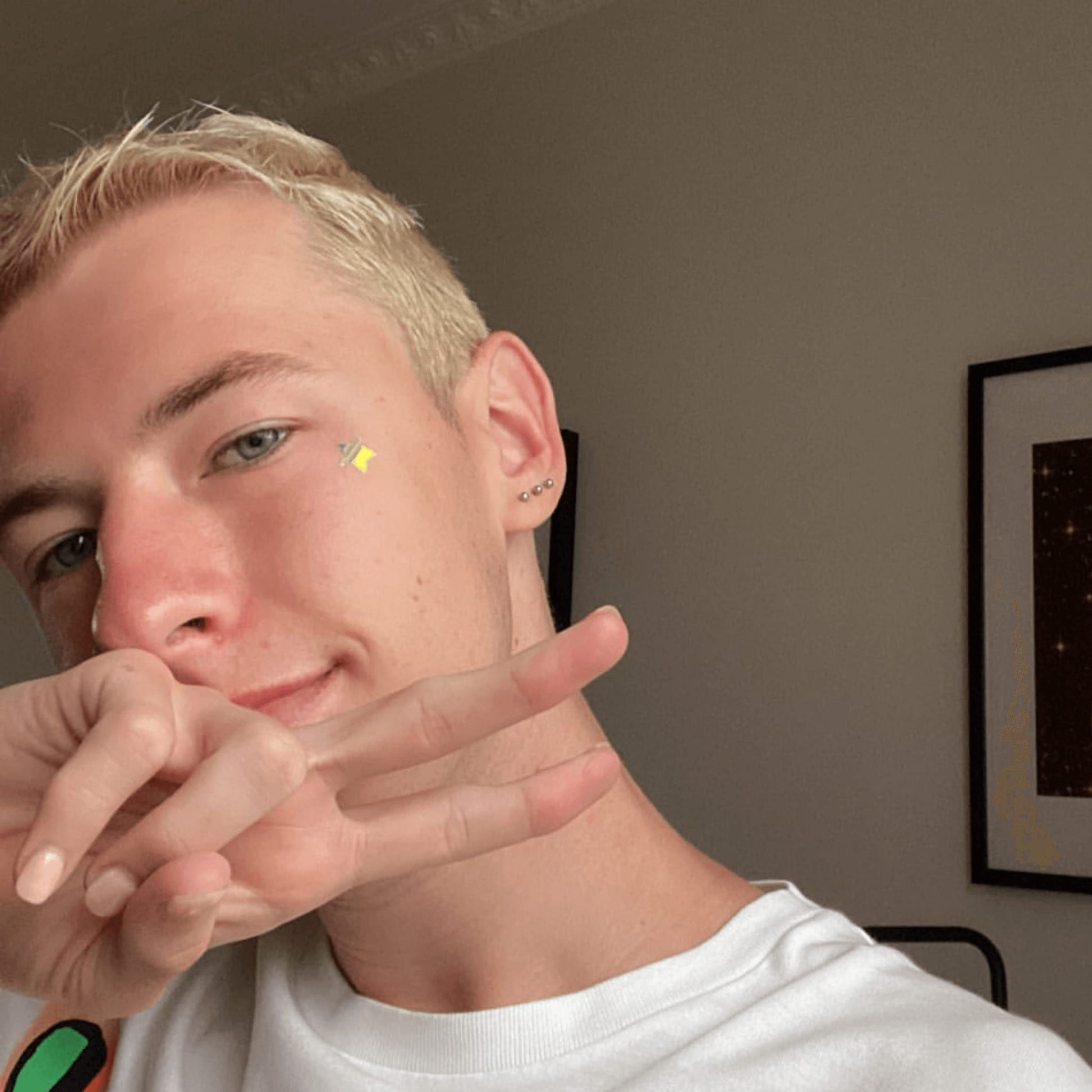 A boy with Holographic Star Pimple Patch