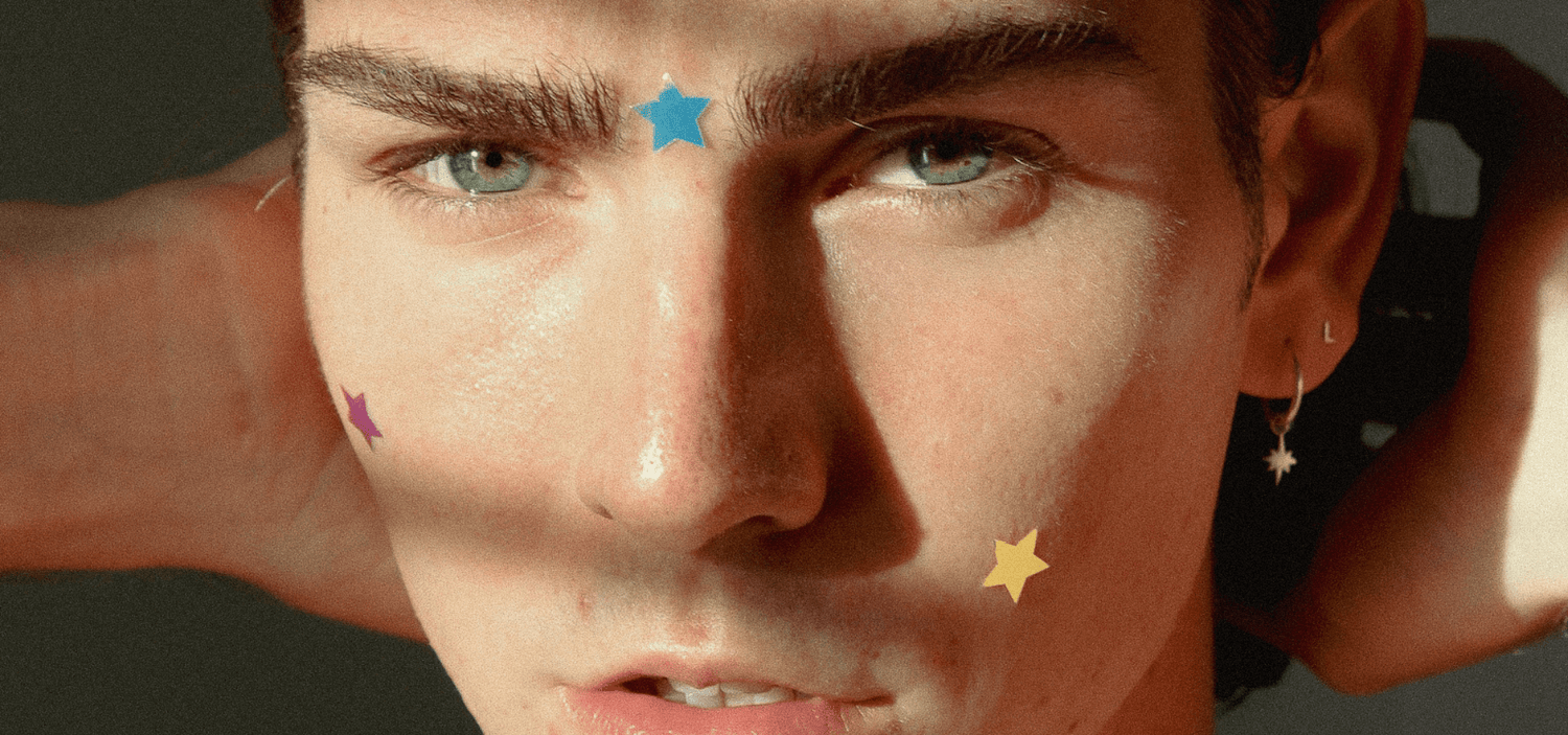 Holographic Star Pimple Patches on boys face healing pimples, zits and whiteheads